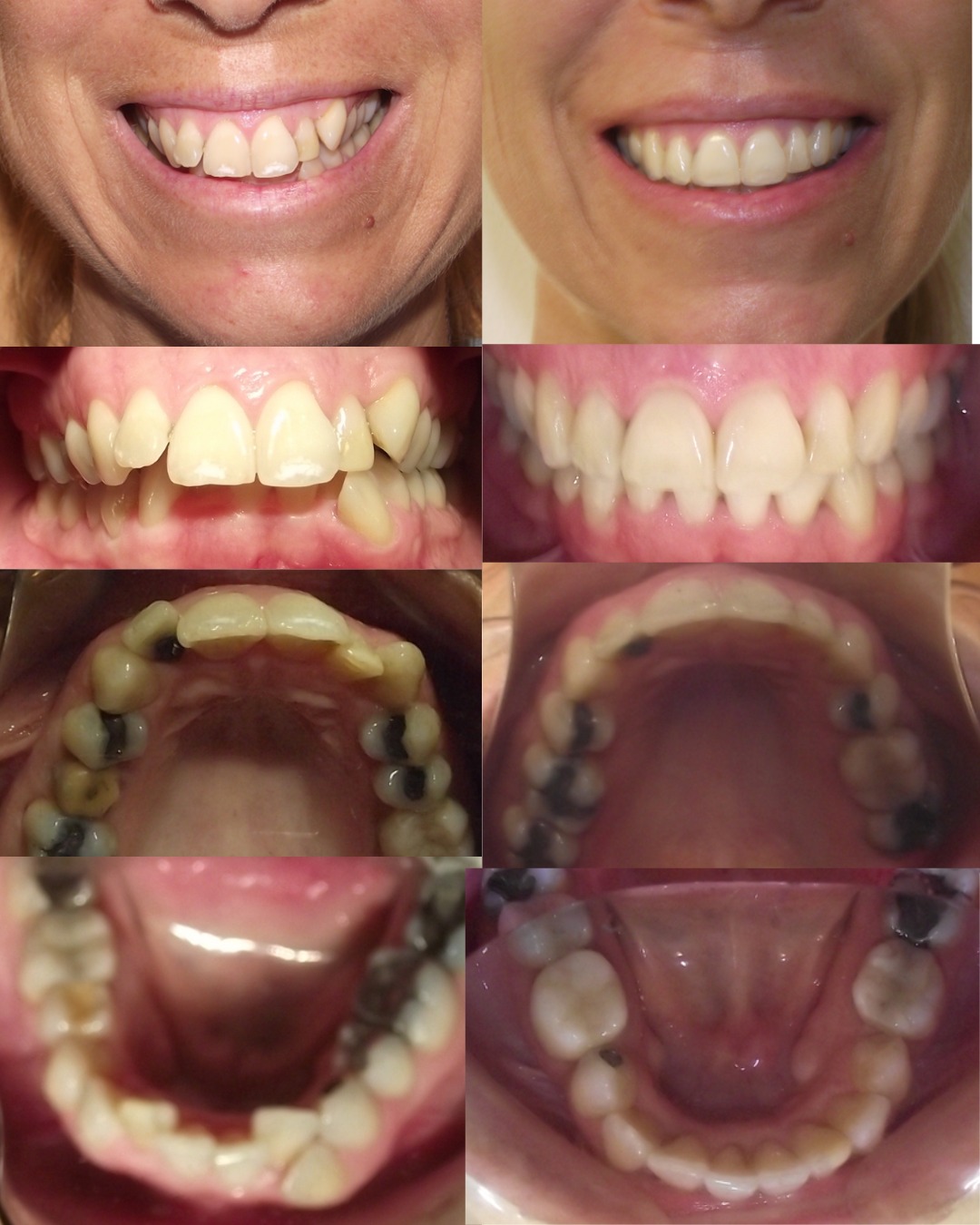 Transformación dental 1