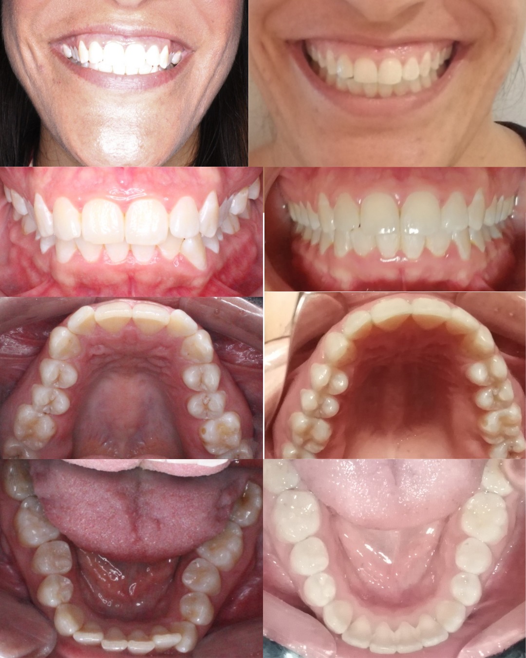 Transformación dental 10