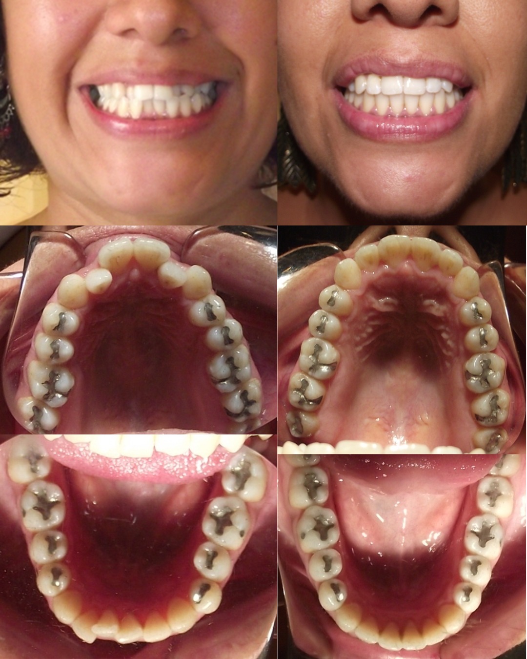 Transformación dental 4