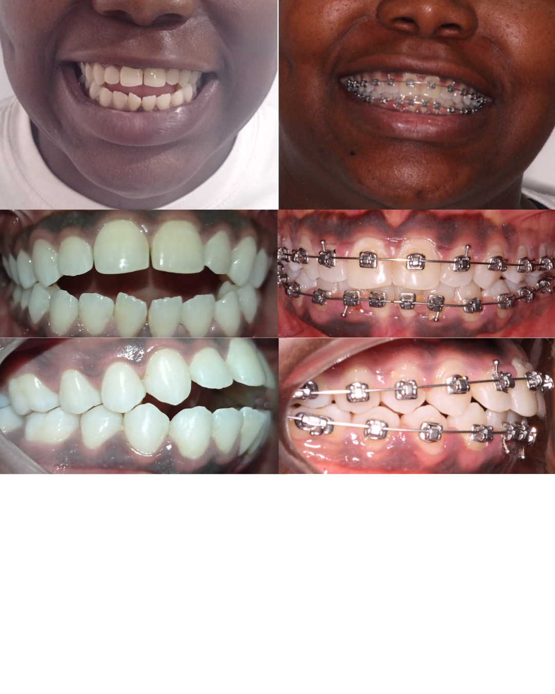 Transformación dental 8