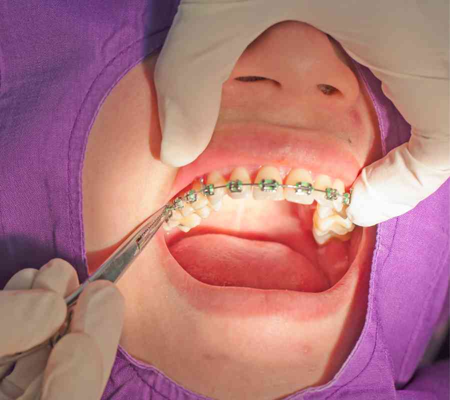 Tratamiento de ortodoncia